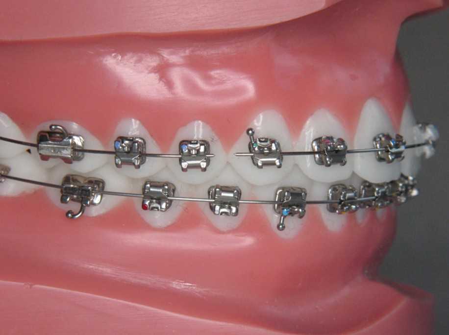 Eerste hulp - Orthodontiepraktijk